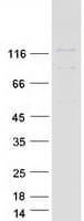 Human PPP6R1 / SAPS1 Protein (Recombinant Myc-DDK (Flag))