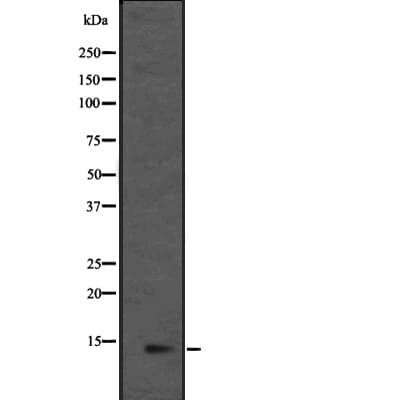 MRPL36 Antibody