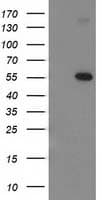 Monoclonal Mouse anti-Human TP53 / p53 Antibody (clone OTI3F5, IHC, IF, WB)