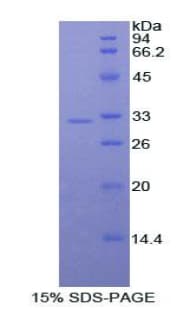 Dog ALCAM / CD166 Protein (Recombinant His)