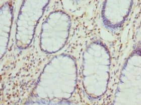 CYTH2 / Cytohesin 2 Antibody
