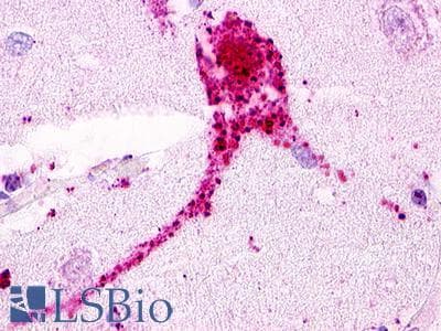 PathPlus™ GPRC5D Antibody (Extracellular Domain)