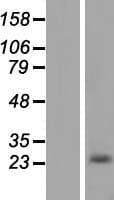 Human Alpha-S1-Casein / CSN1S1 Protein (Over-Expression Lysate Myc-DDK (Flag))