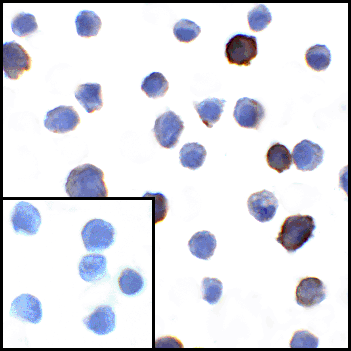 CD274 / B7-H1 / PD-L1 Antibody (clone 1F11)