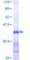 Human ATP2A1 / SERCA1 Protein (Recombinant GST, N-terminus)