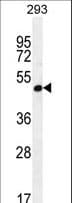 A4GALT Antibody (aa26-54)