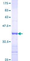 Human REG1A Protein (Recombinant GST, N-terminus)