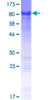 Human KIAA0652 / ATG13 Protein (Recombinant GST)