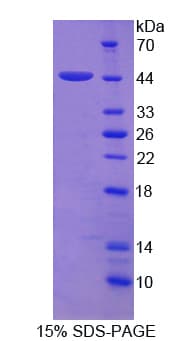 Rat PFKM / PFK-1 Protein (Recombinant His)