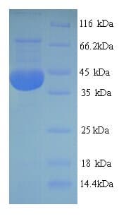 Rat NOX4 Protein (Recombinant His-SUMO)