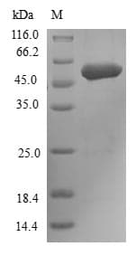 Human FGFR3 Protein (Recombinant 6His-B2M, N-terminus)