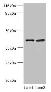 Polyclonal Rabbit anti-Human NUDCD3 Antibody (WB)