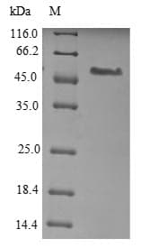 Mouse TEM7 Protein (Recombinant 6His, N-terminus)