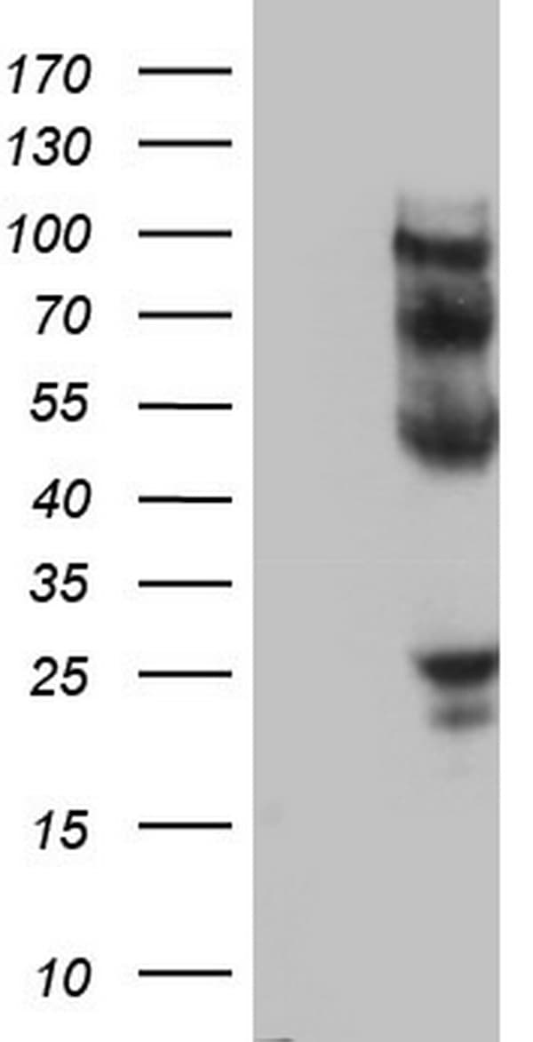 PROCR / EPCR Antibody (aa1-210, clone OTI7A4)