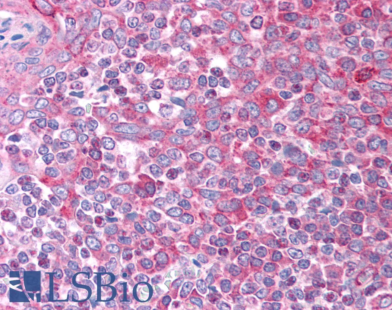 CCL7 / MCP3 Antibody (aa30-79)