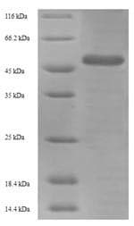 Influenza A Virus Hemagglutinin Protein (Recombinant 6His-SUMO, N-terminus)