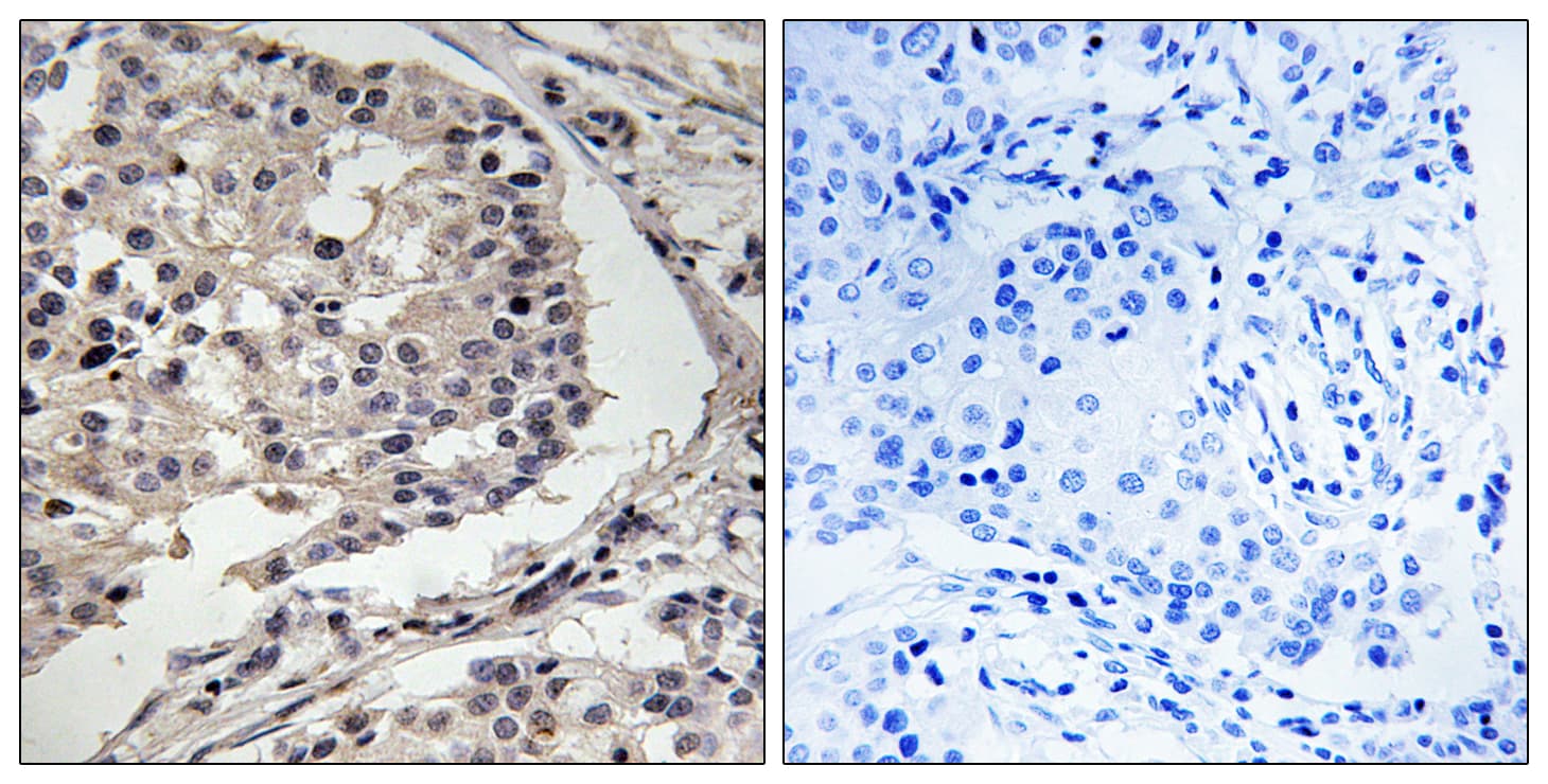 Polyclonal Rabbit anti-Human MLK1+2 Antibody (aa281-330, IHC)