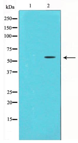 Polyclonal Rabbit anti-Human CHEK1 / CHK1 Antibody (WB)
