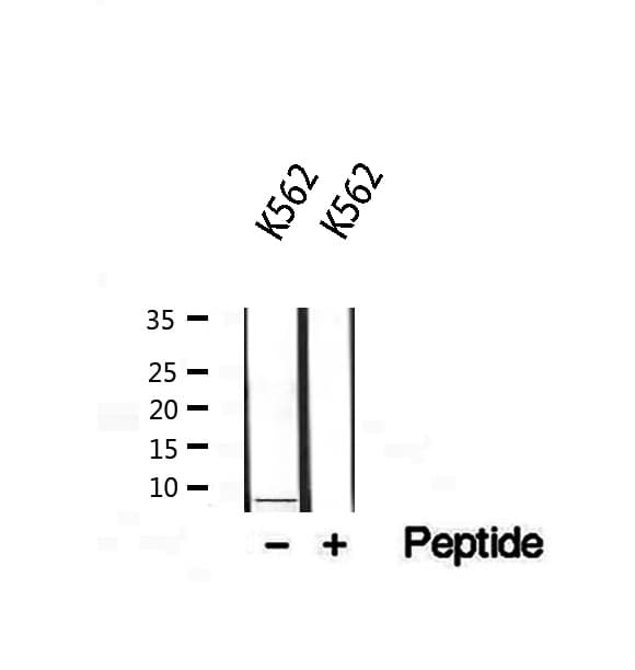 Polyclonal Rabbit anti-Human NFYC Antibody (IHC, WB)