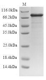 Human ALDP / ABCD1 Protein (Recombinant 10His, C-terminus)