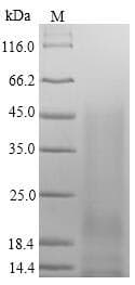 Mouse JCHAIN / Ig J Chain Protein (Recombinant 6His, N-terminus)