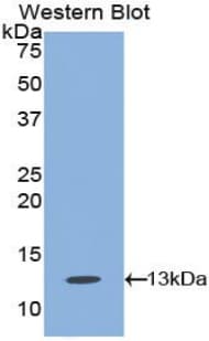 HAVCR1 / KIM-1 Antibody (aa23-125, APC)