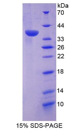 Human DUSP6 / MKP3 Protein (Recombinant His-S)