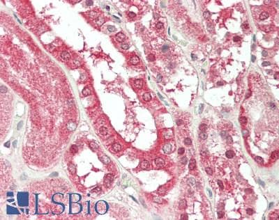 IHC-plus™ Polyclonal Rabbit anti-Human NEDD4 Antibody (IHC, WB)