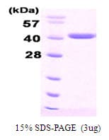 Human DNAJB1 / Hsp40 Protein (Recombinant His)