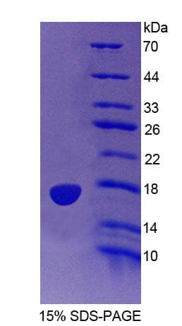 Human PTPMT1 Protein (Recombinant His-T7, N-terminus)