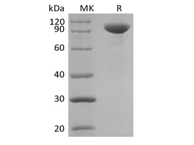 Human IL23A / IL-23 p19 Protein (Recombinant Fc, C-terminus)
