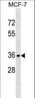 Polyclonal Rabbit anti-Human TOR1A / Torsin A Antibody (aa267-295, WB)