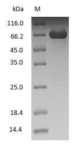 ALB / Serum Albumin Protein (Native)