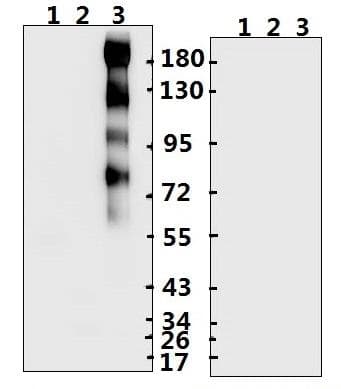Polyclonal Rabbit anti-Coronavirus SARS-CoV-2 Spike Glycoprotein Antibody (aa 803-817, WB)