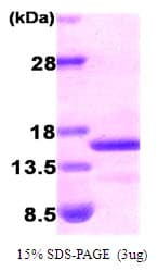 Human NPPB / BNP Protein (Recombinant His)