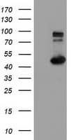 IFT57 / HIPPI Antibody (clone OTI1H2)