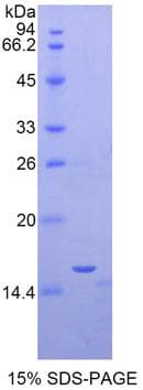 Mouse EPO / Erythropoietin Protein (Recombinant His-T7)