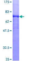 Human GC / Vitamin D-Binding Protein (Recombinant GST)