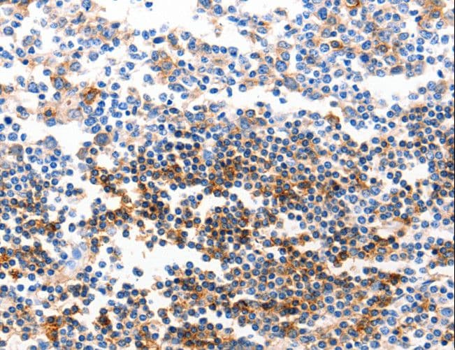 IHC-plus™ Polyclonal Rabbit anti-Human GJB6 / CX30 / Connexin 30 Antibody (IHC)
