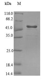Mouse GRHPR / Glyoxylate Reductase Protein (Recombinant 6His-SUMO, N-terminus)