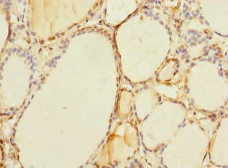 TAPBPL / TAPBPR Antibody