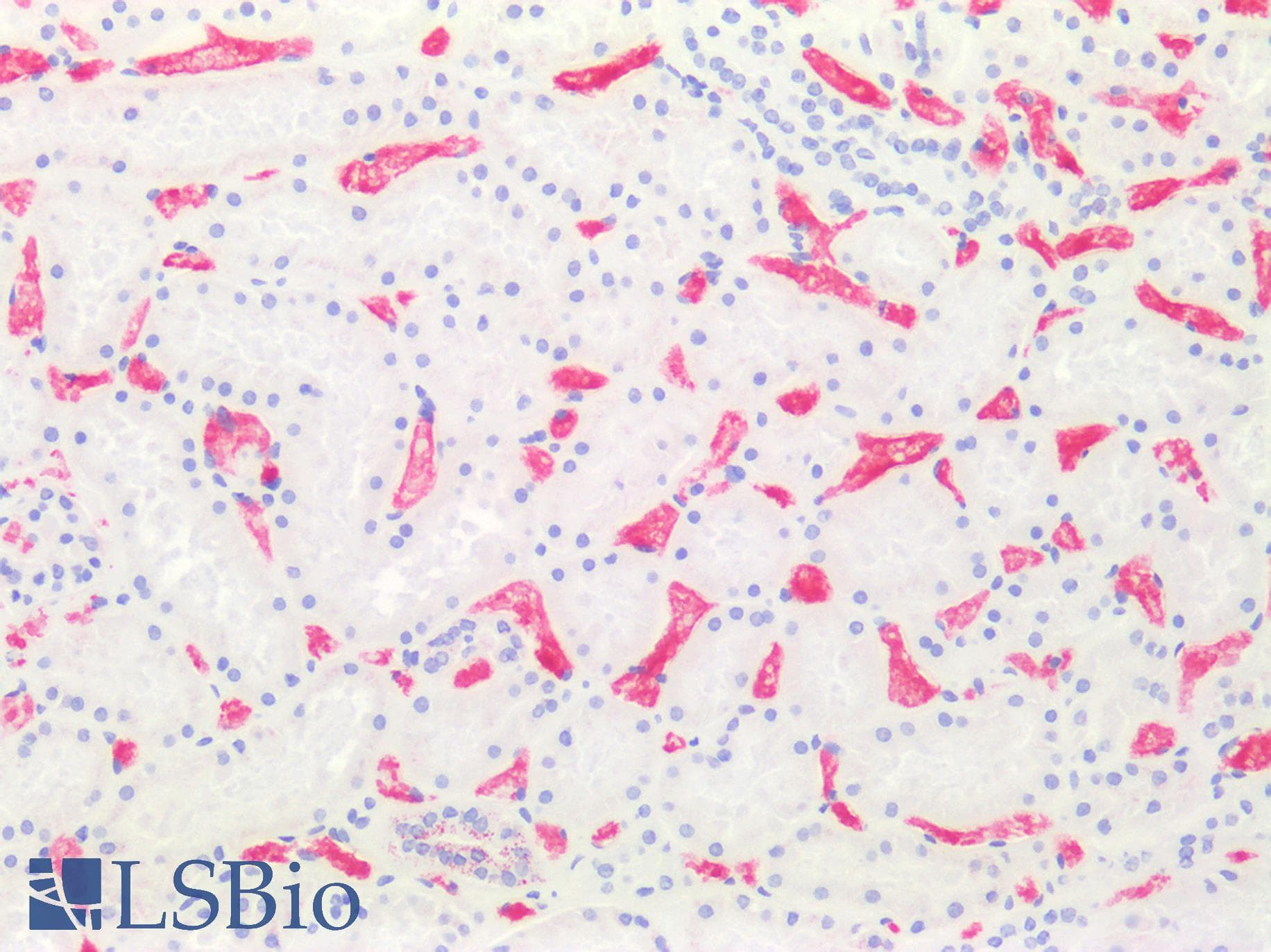 IHC-plus™ Monoclonal Mouse anti-Human SLC4A1 / Band 3 / AE1 Antibody (clone 2D5, IHC, IF, WB)