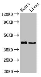 HDAC8 Antibody