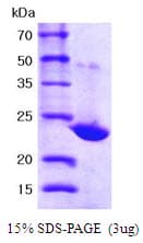 Human PRDX1 / Peroxiredoxin 1 Protein (Recombinant His)