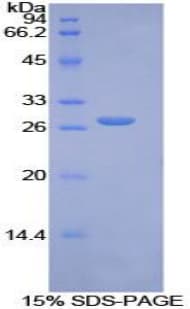 Rat AXIN1 / Axin-1 Protein (Recombinant His-T7)