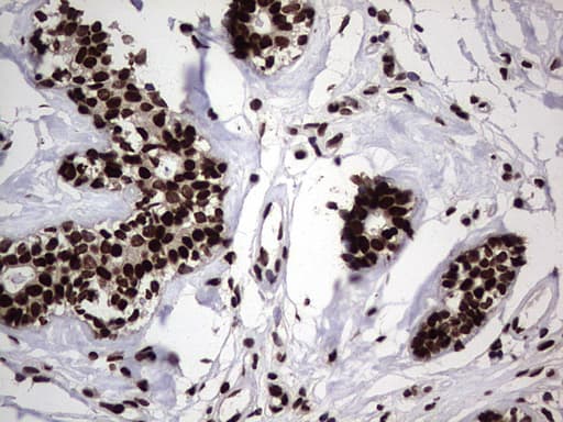 HNRNPL / hnRNP L Antibody (aa270-502, clone OTI9G7, Carrier-free)