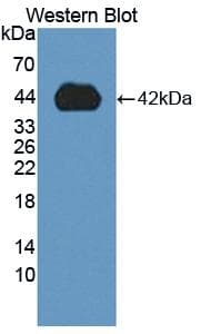 CASP9 / Caspase 9 Antibody (aa331-416, APC)