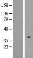 SFXN5 / Sideroflexin 5 Protein (Over-Expression Lysate Myc-DDK (Flag))
