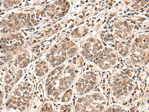 HGH1 / FAM203A Antibody