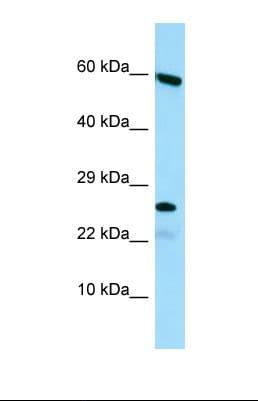 Polyclonal Rabbit anti-Human HGSNAT Antibody (N-Terminus, WB)